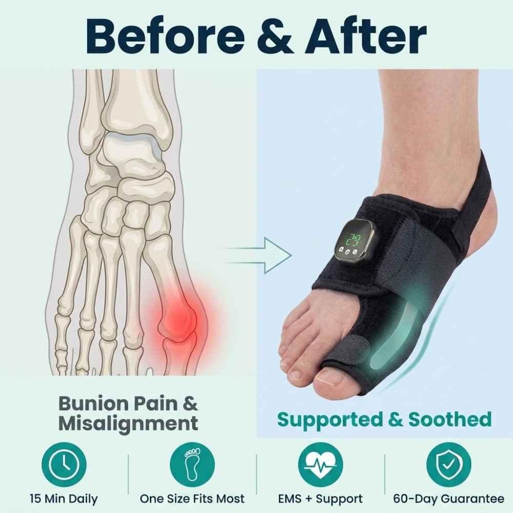 BLAYEN — EMS Bunion Corrector